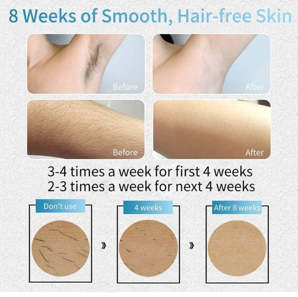 VEME IPL Hair Removal for Women & Men at Home Use Permanent Reduction in Hair Re - Picture 5 of 9